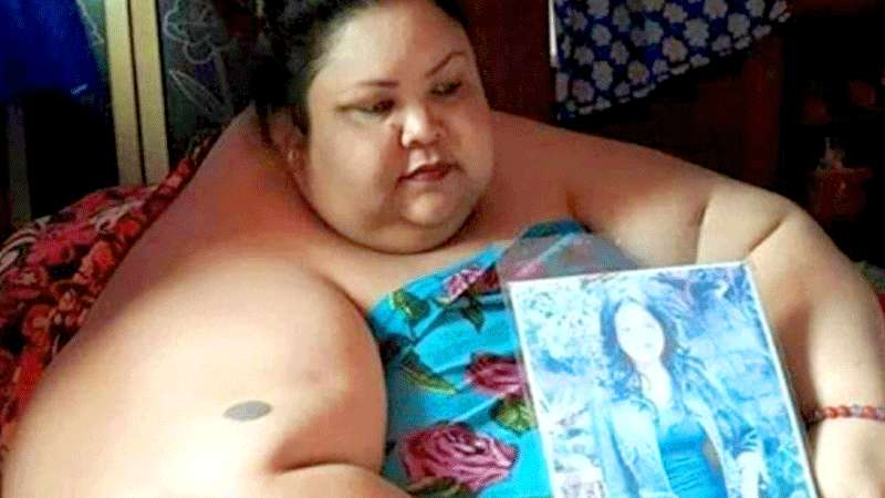 Wanita 350 Kilogram Tidak Bisa Berdiri