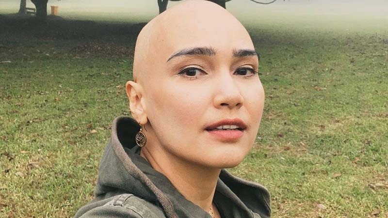 Feby Febiola Syok Tumor 16cm Bersarang di Tubuhnya