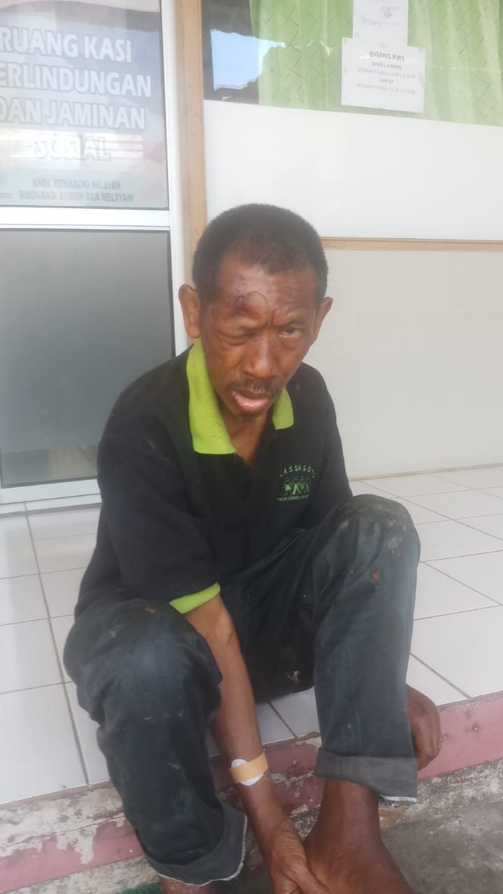 Banyak ODGJ Tanpa Identitas Ditangani Dinsos Banyumas, Rata-Rata Luar Kabupaten