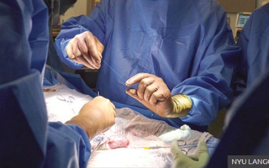 Transplantasi Ginjal Babi ke Manusia Sukses Dilakukan, Peneliti: Cocok Seperti Halnya Ginjal Manusia Normal
