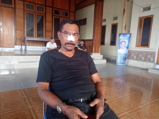 DPO Mabes Polri Aniaya Mantan Bupati Boltim, Hidung Digigit hingga Putus Didepan Kapolres