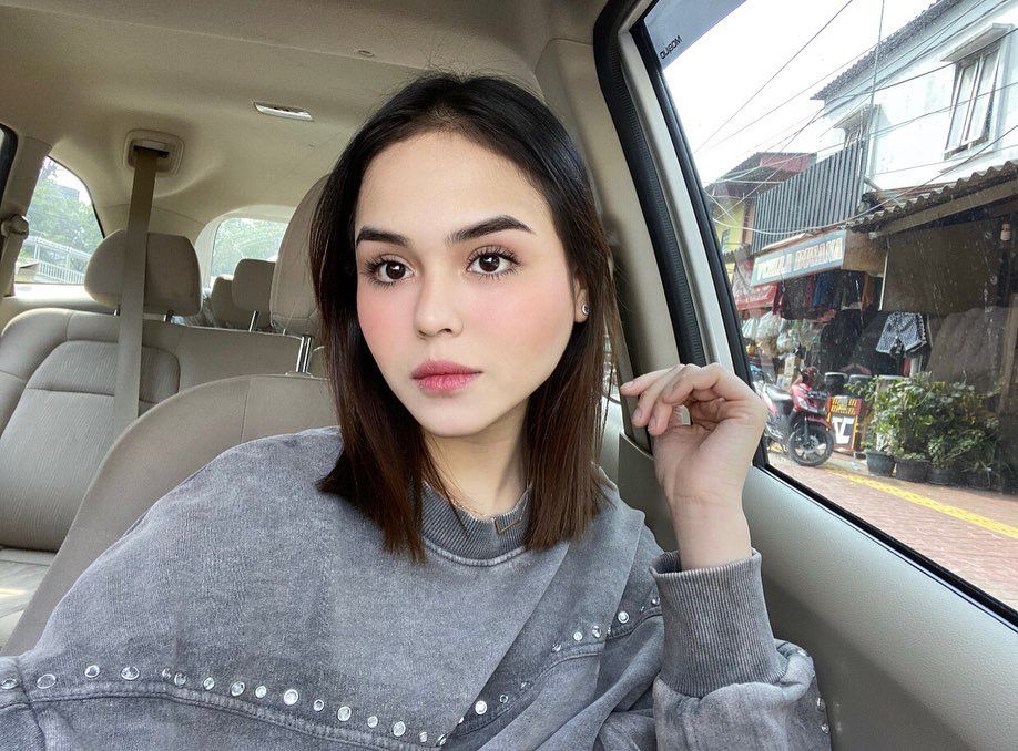 Selebgram Laura Anna Tuntut Tanggung Jawab Eks Pacar, Kecelakaan Bikin Lumpuh