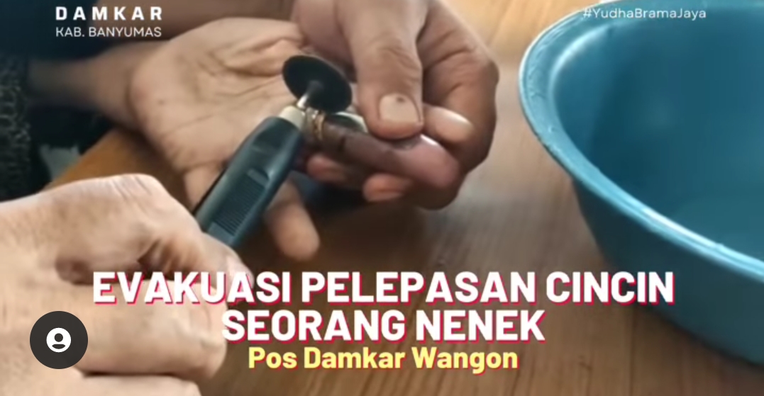 Petugas Damkar Banyumas Bantu Nenek-Nenek Lepas Cincin