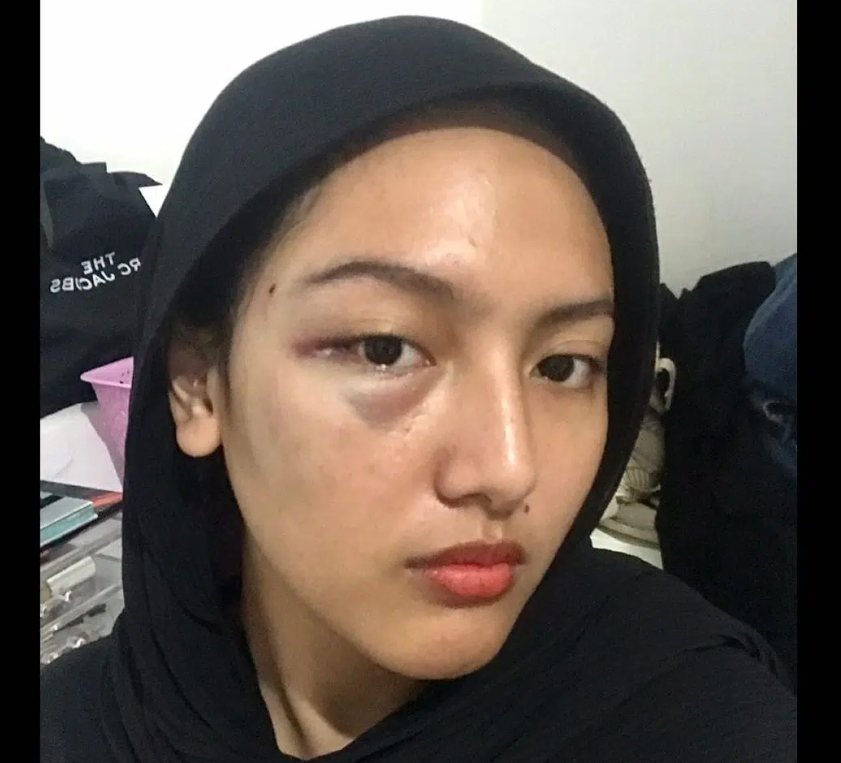 Viral, Gadis Cantik Babak Belur Lindungi Ibunya dari Pria Mabuk yang Bobol Rumahnya