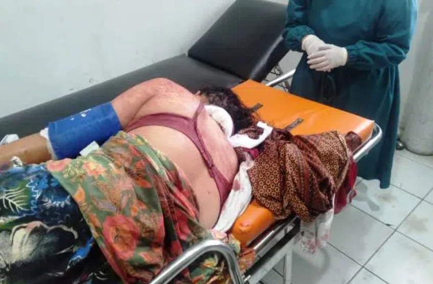 Bacok Istri dan Anak Kandungnya, Terkapar Bersimbah Darah