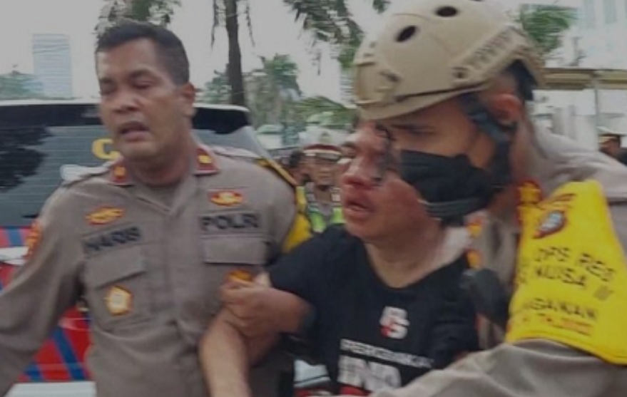 Babak Belur, Kini Ade Armando Gelar Sayembara Cari Pelaku yang Melucuti Celana, Berhadiah Rp50 Juta