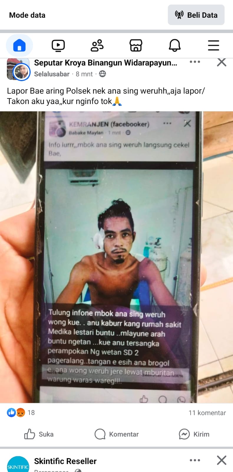 Pelaku Perampokan di Pageralang Kabur dari Rumah Sakit, Kapolsek: Hoax