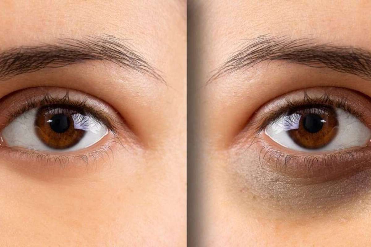 Mengenali Tanda-tanda Gangguan Kesehatan Mata dari Mata Seseorang