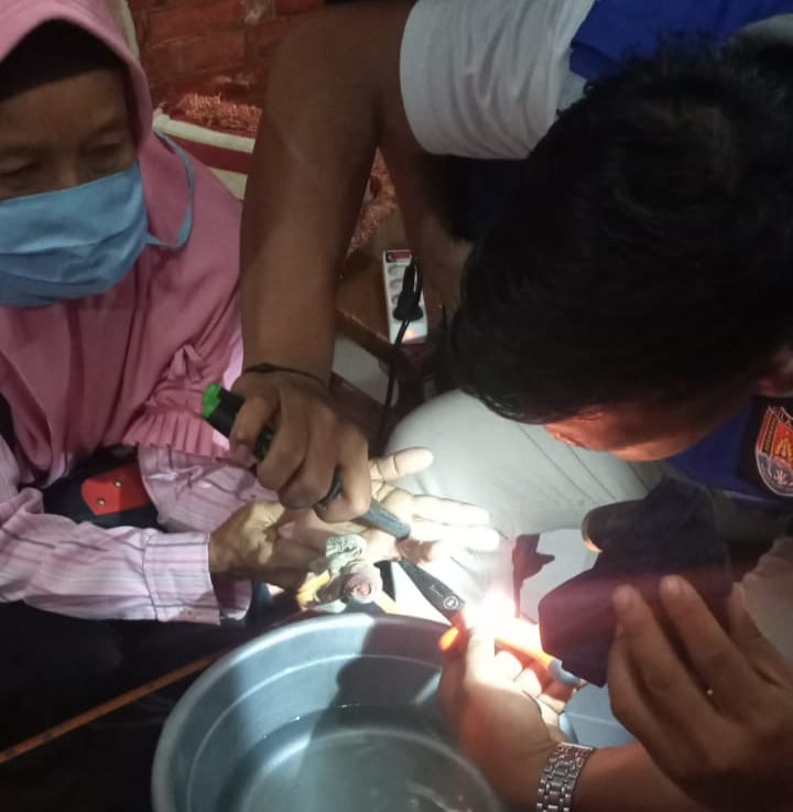 Cincin Sulit Dilepas, Warga Kesugihan Datangi Damkar Cilacap 