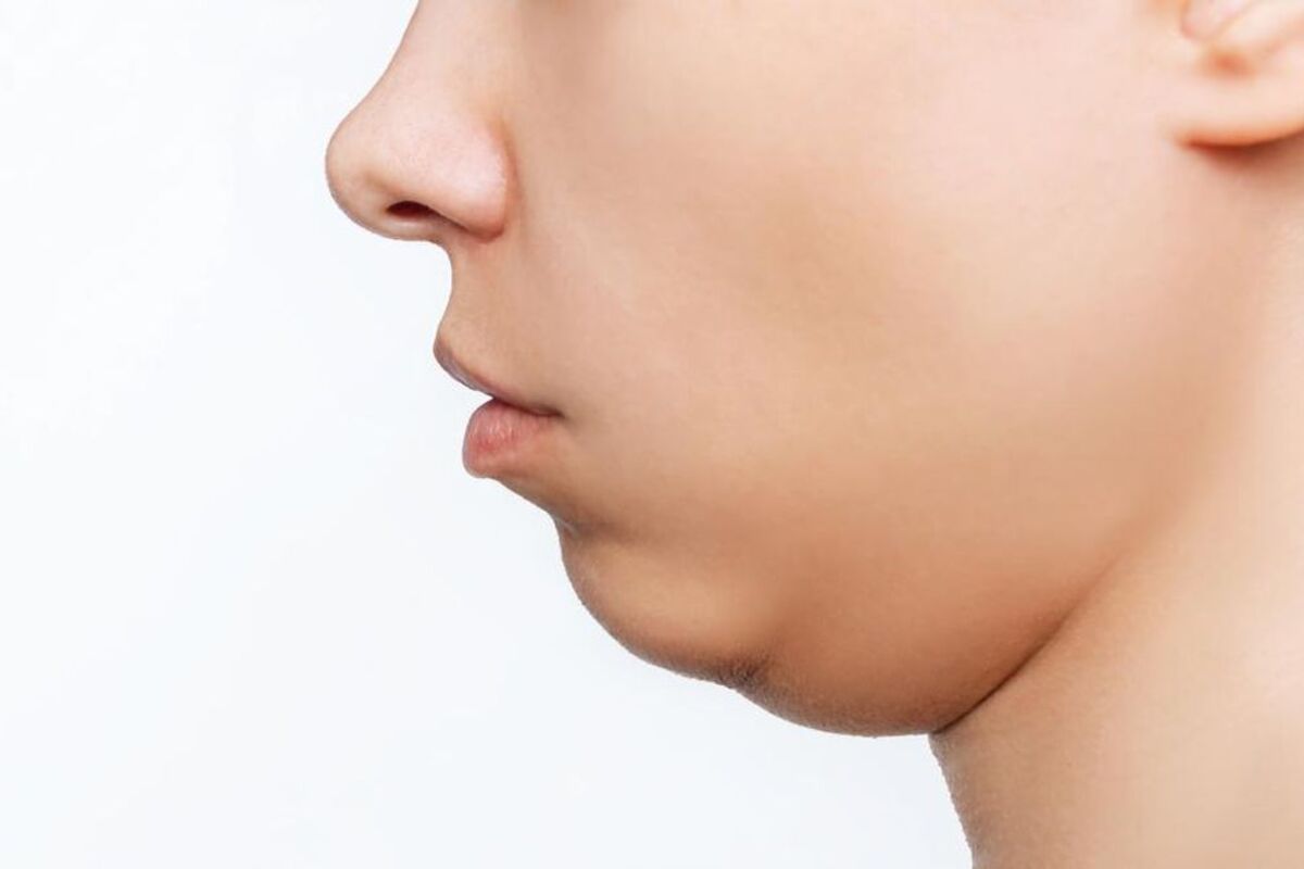 Ingin Menghilangkan Double Chin? Yuk , Coba Teknik Senam Wajah yang Super Mudah