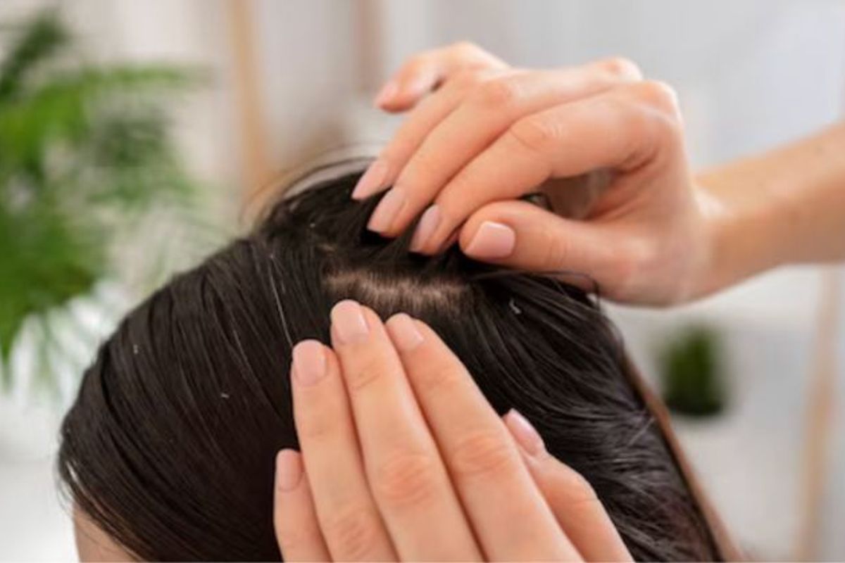 Cara Jitu Mengatasi Minyak Berlebih Pada Kulit Kepala Dengan Mudah