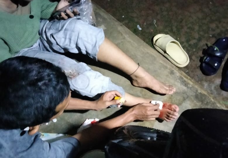 Lubang Aspal Jalan Kabupaten Ruas Kemranjen-Tanggeran Makan Korban