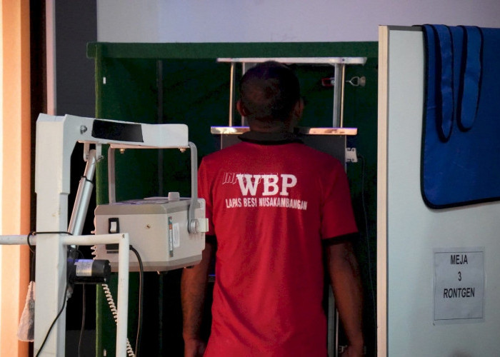 Cegah Penularan TBC, Ratusan Warga Binaan Lapas Besi di Skrining Massal 