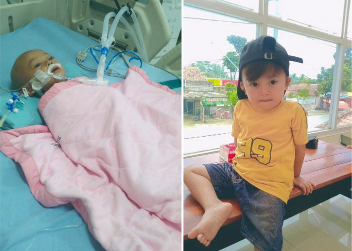 Pendampingan Pasien dan Rumah Singgah Kuatkan Baznas Banyumas Untuk Menjaga Hifdzun Nafs