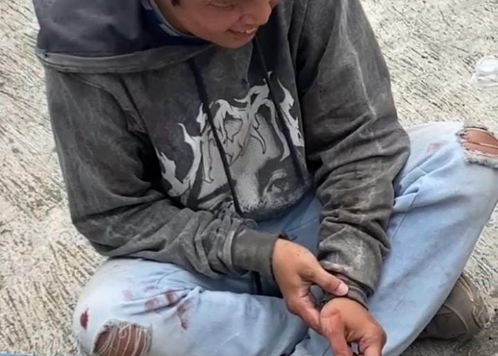 Kabur Tak Bayar Bensin dan Rokok, Pria Tabrak Tiang, Aksi di Warung Karanglo Cilongok Berakhir Damai