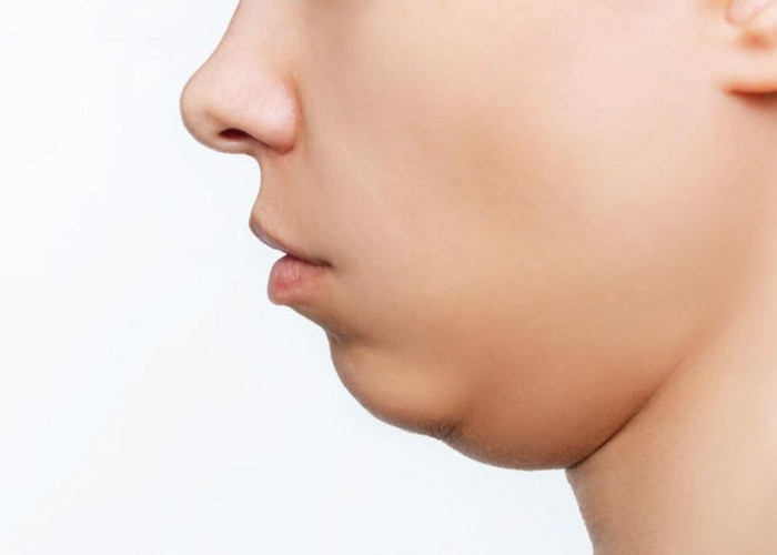 Ingin Menghilangkan Double Chin? Yuk , Coba Teknik Senam Wajah yang Super Mudah