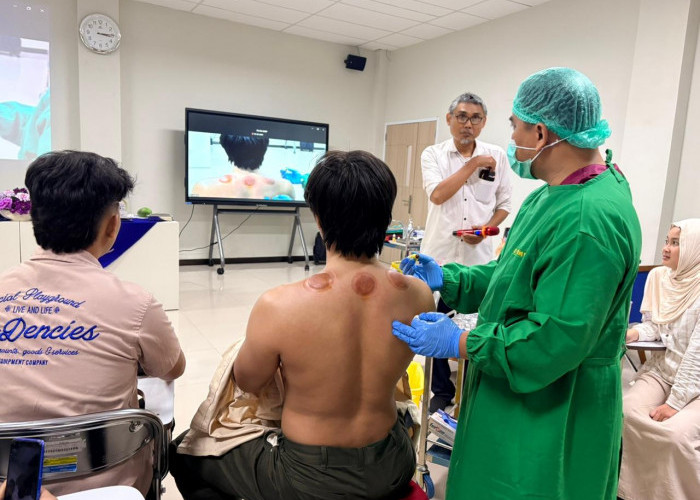 Antusiasme Tinggi Warnai Workshop Bekam Medis Mahasiswa FK UMP