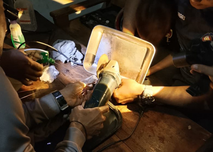 Jari Bocah Tersangkut Jalu Sepeda, Damkar Banyumas Evakuasi Korban Selama Tiga Jam